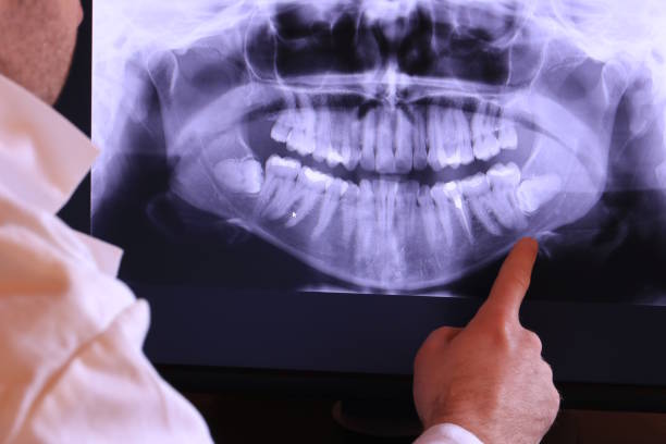 Best 24-Hour Emergency Dentist in Tahoka, TX