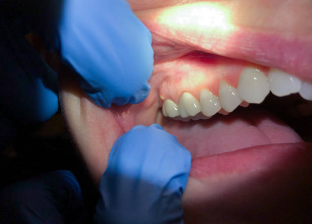 Best Pediatric Emergency Dentist in Tahoka, TX